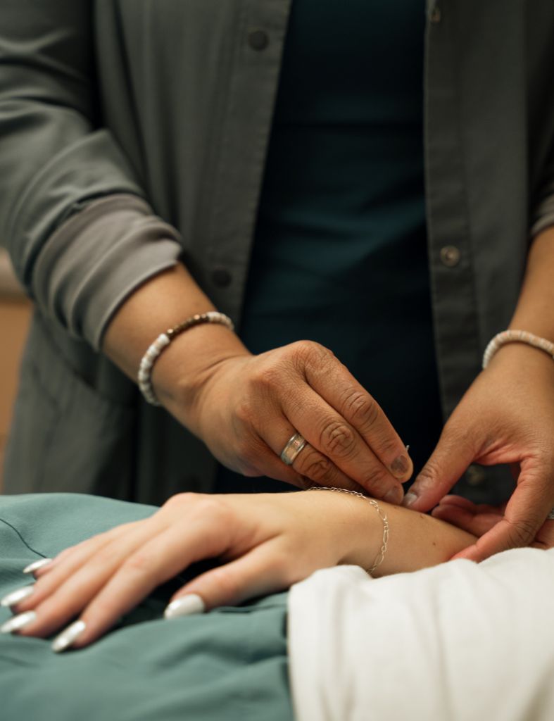 Acupuncture treatment being performed at Tennessee Health & Wellness in Cookeville, TN
